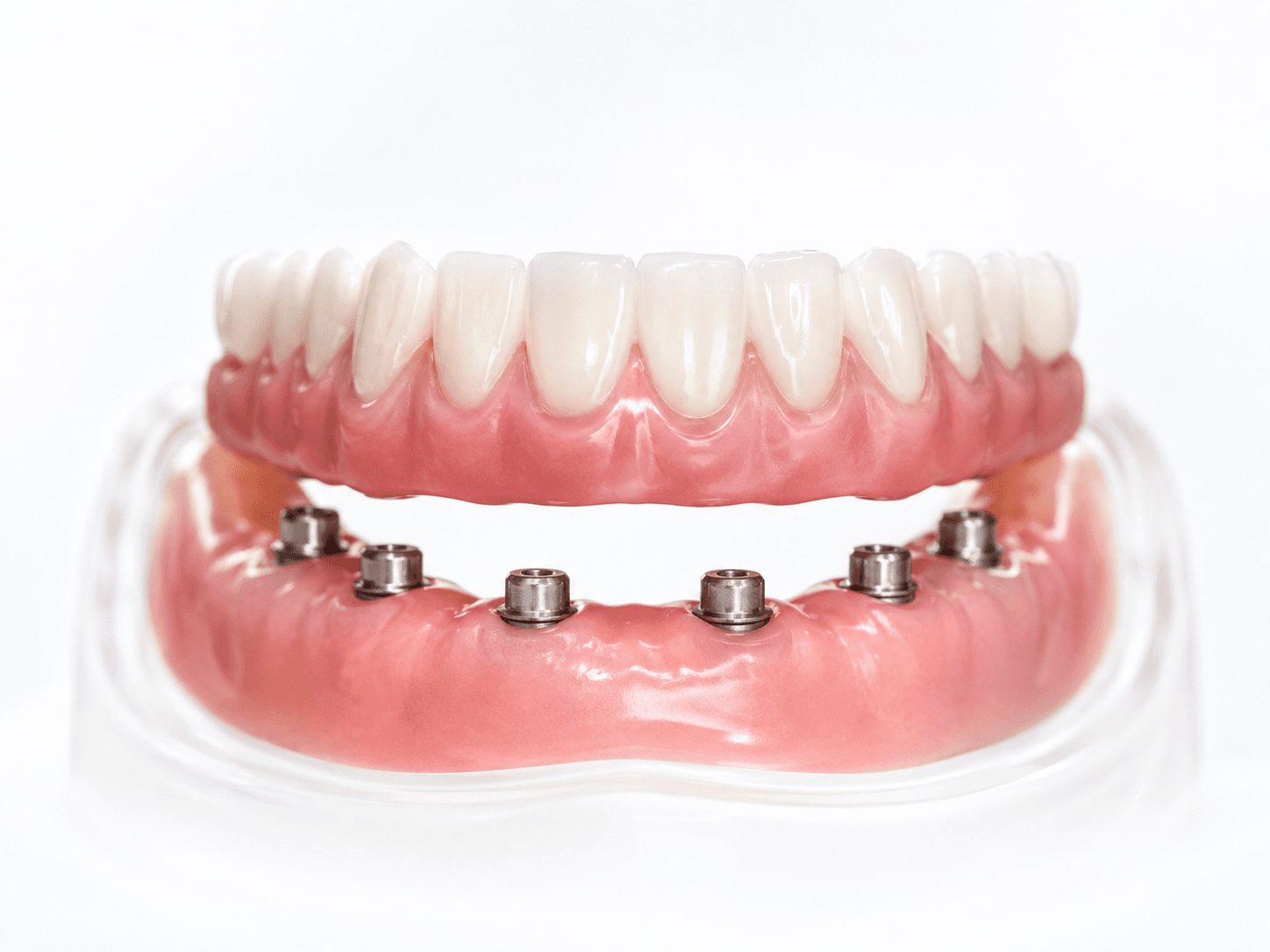 Rehabilitación oral